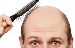 Hair Loss treatment